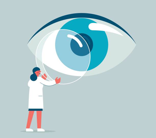 Cataract Surgeon Aizawl