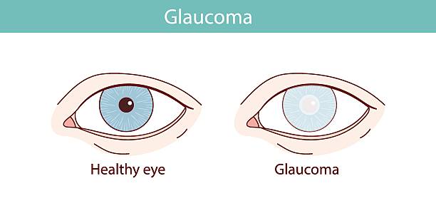 Eye Infection Specialist Mizoram 